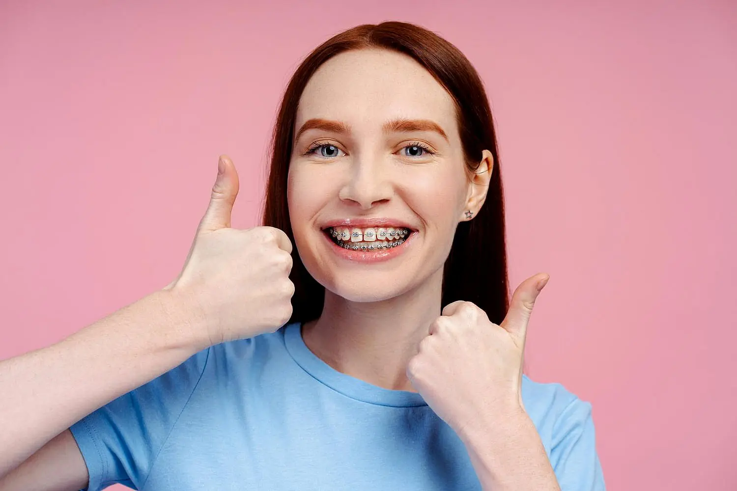 Person with long hair wearing braces and a blue shirt, proudly giving two thumbs up in front of a pink background, showcasing that perfect smile made possible with the help of orthodontic insurance in Suwanee or Tucker, GA