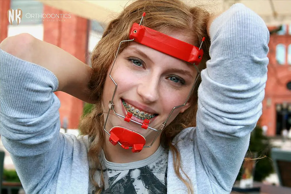 A person with braces and a red orthodontic reverse pull headgear braces from NK Orthodontics, smiling with arms raised behind their head in Suwanee or Tucker, GA