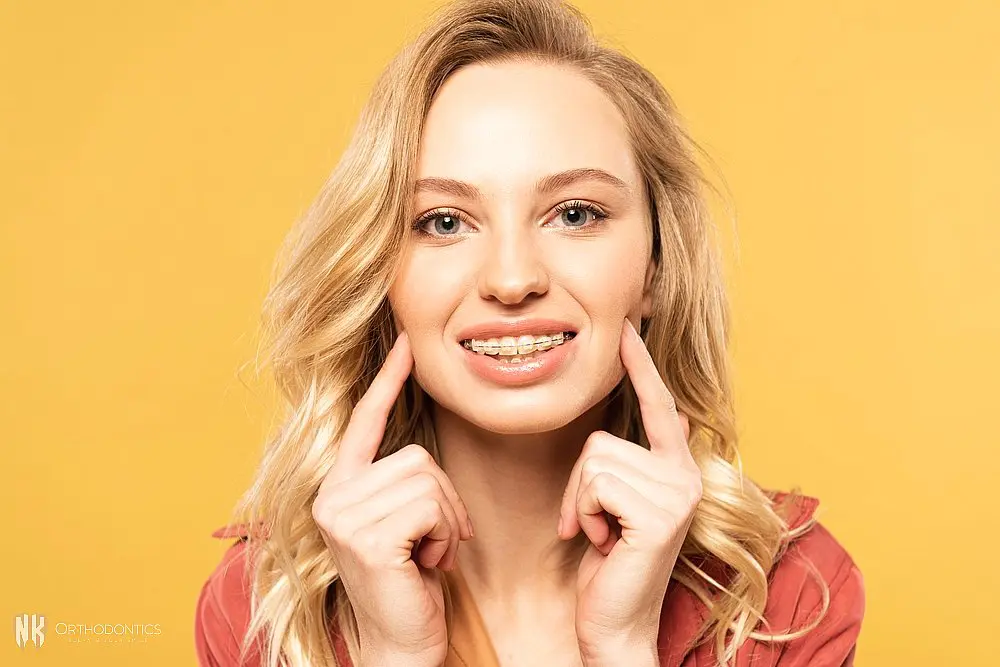 smiling blonde woman clear braces looking camera - overbite vs underbite in Suwanee and Tucker, GA.