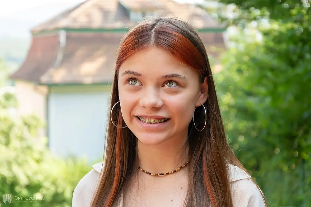 beautiful teenage girl metal braces smiles street - Clear Braces vs Metal Braces in Suwanee and Tucker, GA 