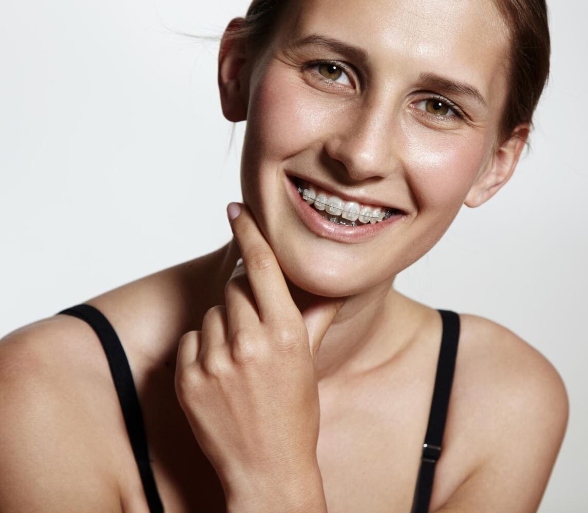 A person is smiling confidently while wearing clear braces, gently holding their chin with one hand against a neutral background in Tucker, GA